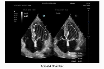 TE7 Max Portable Ultrasound by Mindray